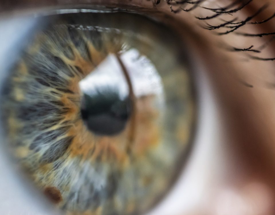 what is an astigmatism