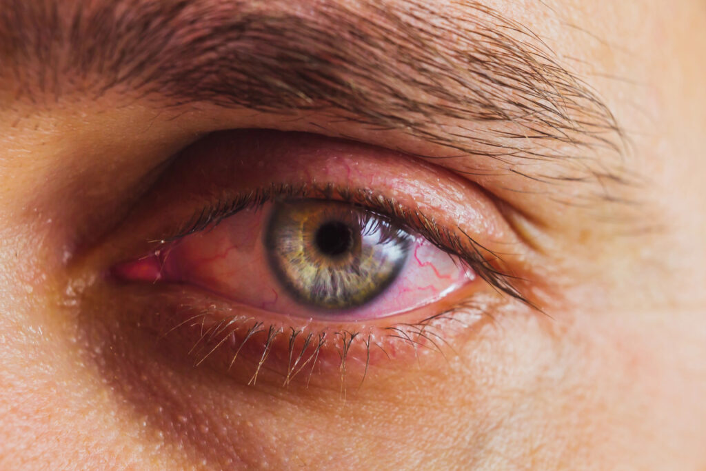 Close-up of a person's blue-green eye with visible red veins, suggesting the possibility of sore eyes. The well-defined eyebrow complements the striking detail.