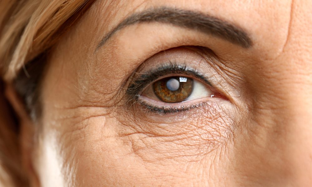 Close-up of a mature person's eye, highlighting detailed wrinkles around the area and slightly arched eyebrow. The eye, open and looking straight ahead, shows no symptoms of cataracts.