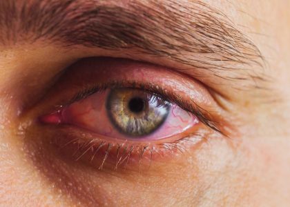 Close-up of a person's blue-green eye with visible red veins, suggesting the possibility of sore eyes. The well-defined eyebrow complements the striking detail.