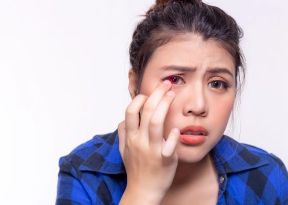 A woman in a blue plaid shirt touches her eye, which appears irritated, possibly because her contact lens is stuck.