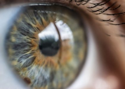A close-up of a person's eye with an astigmatism.